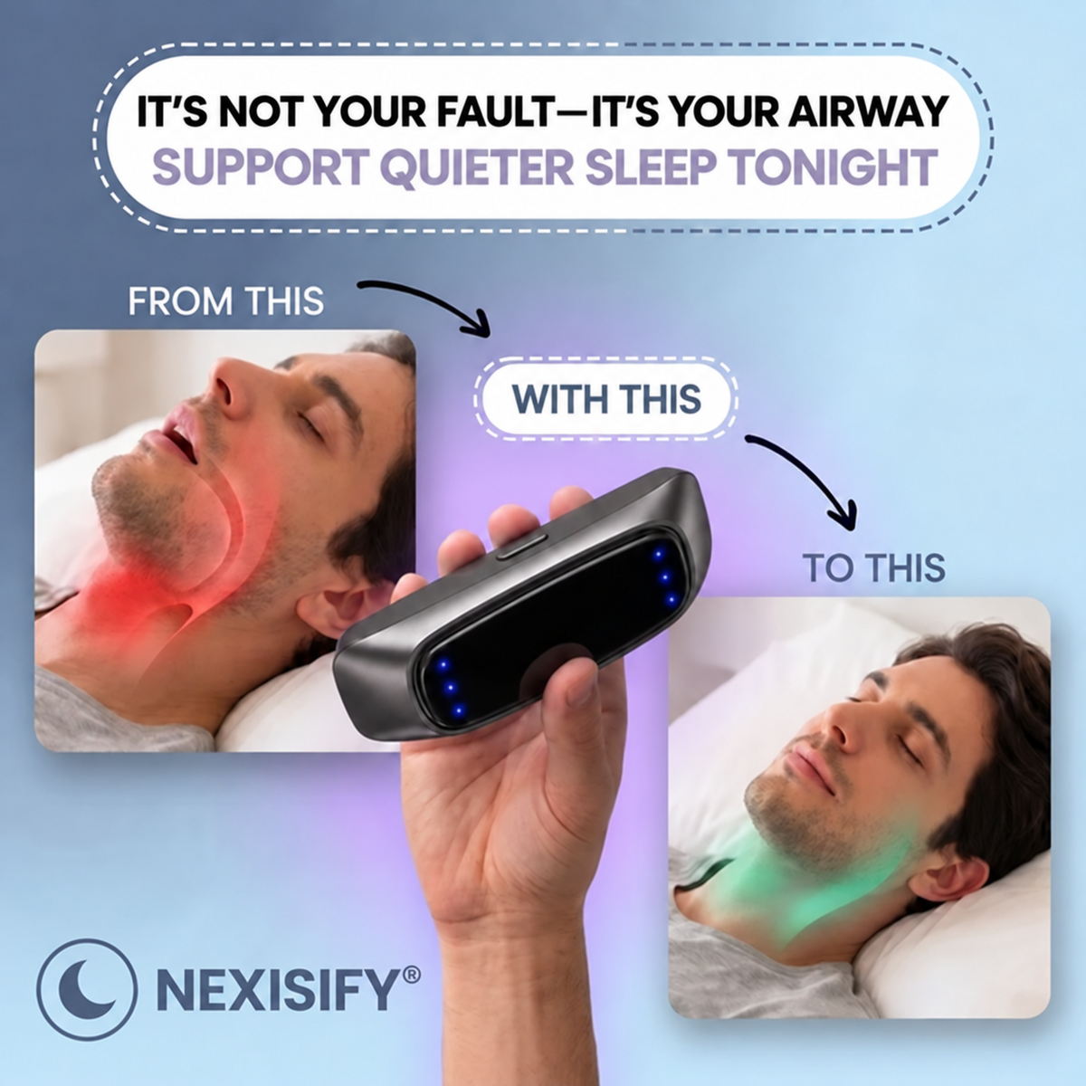😴 Smart Anti-Snoring Device – Quieter Nights, Better Sleep