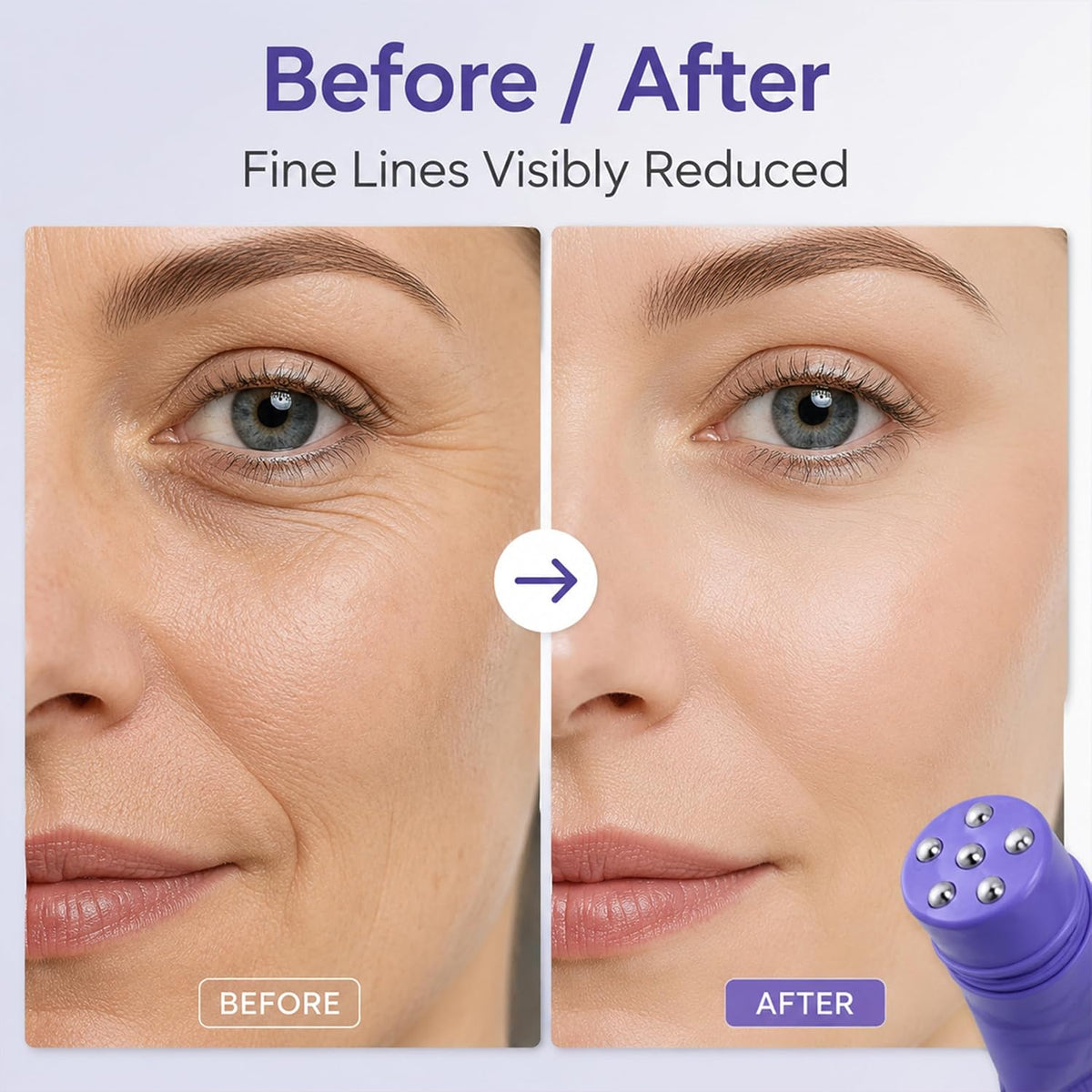 Slimoly Instant Wrinkle Smoothing Roller Cream